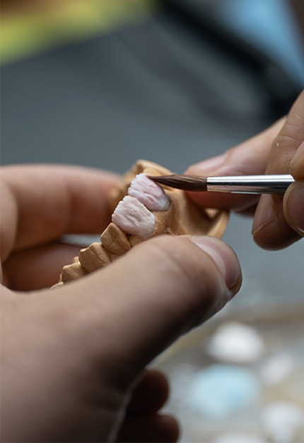 ISIMDANG  심미보철